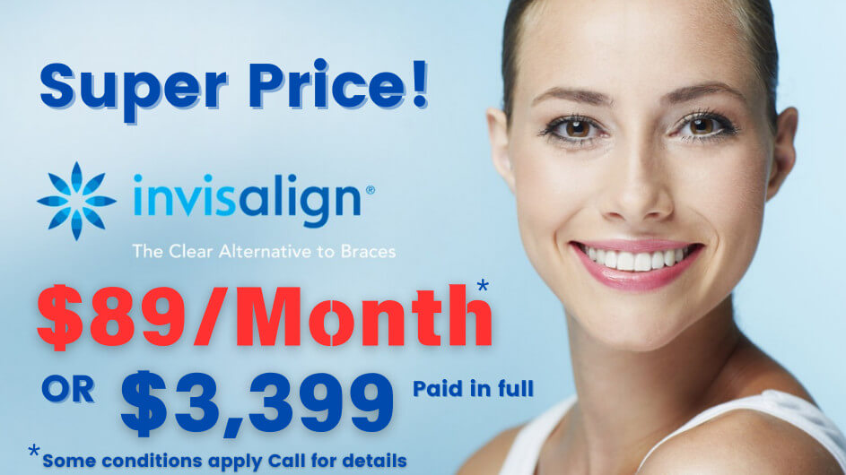 invisalign